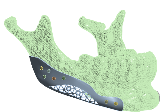 ANSYS Analizi
