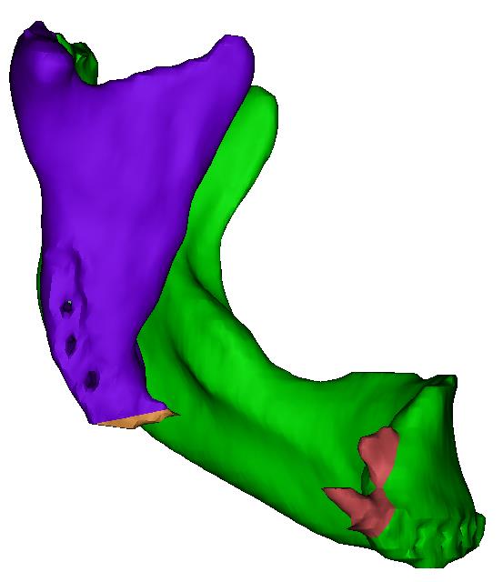 Vaka 3
